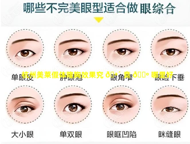 杭州美莱假体隆胸效果究 🪴 竟 🐺 哪里好